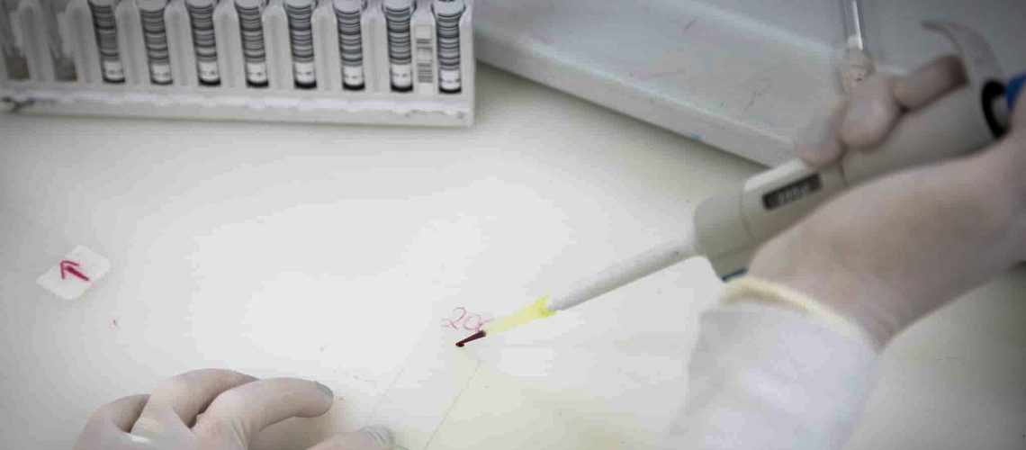 exames-descartam-ebola-em-imigrante-da-republica-democratica-do-congo